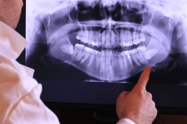 Best Urgent Care for Lost Fillings or Crowns in Byesville, OH