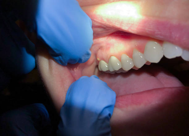 Best Same-Day Emergency Dental Services in Byesville, OH