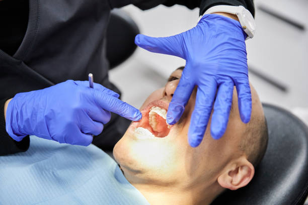 Best Emergency Wisdom Teeth Removal in Byesville, OH