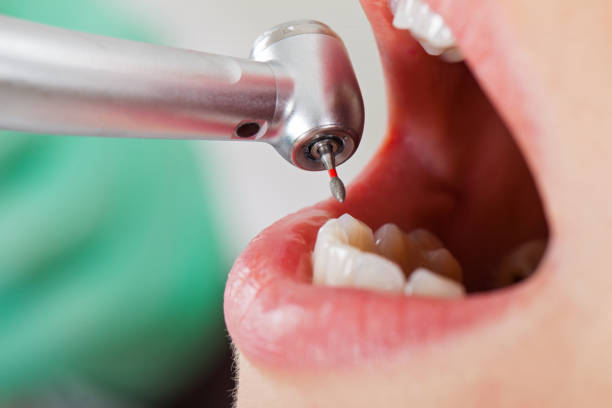 Best Same-Day Emergency Dental Services in Byesville, OH